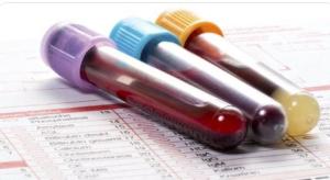 MEDISCH: Nieuwe aanbevelingen voor lipoproteïne(a) bloedtest om