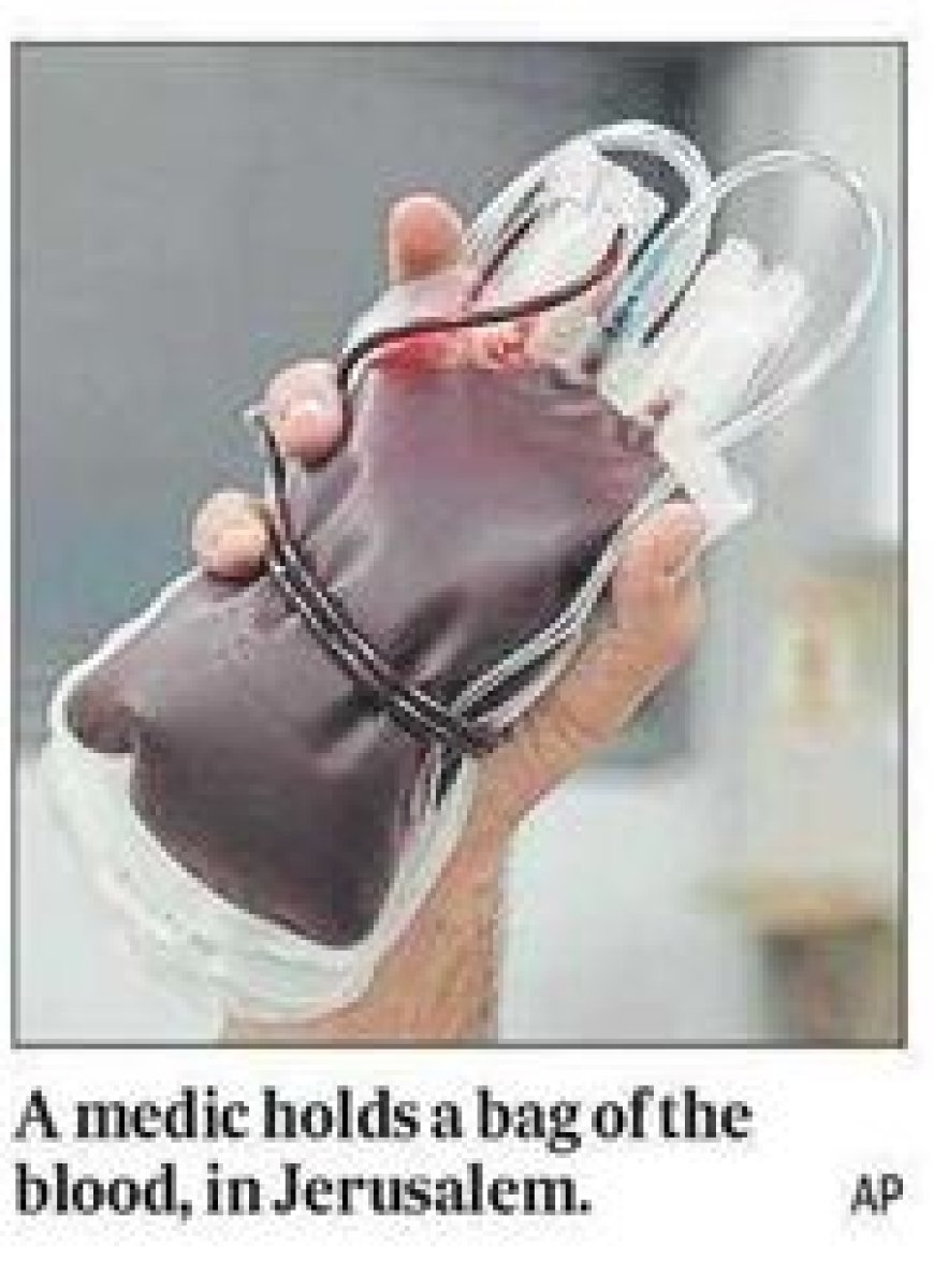 Franse wetenschappers ontdekken nieuwe bloedgroep bij Guadeloupe-vrouw