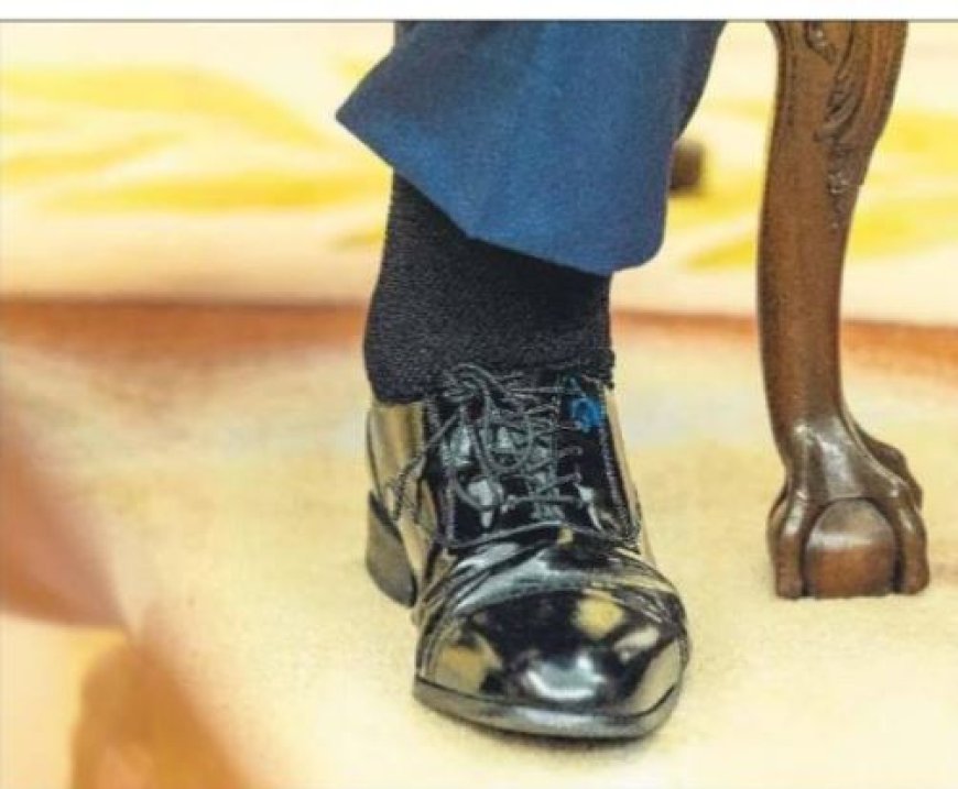 Trump onderzocht op ‘lichte’ zwelling in onderbeen