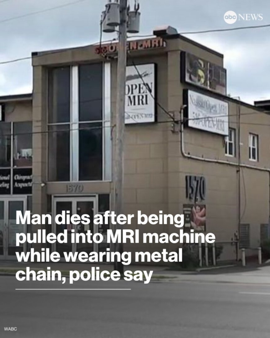 Opmerkelijk – Amerikaan (61) overlijdt nadat hij door zware halsketting in MRI-scanner was ge