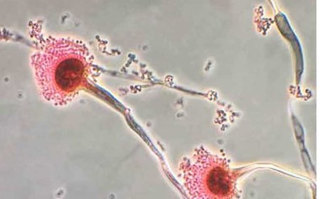 Wereldwijde waarschuwing voor dodelijke schimmel die ‘je van binnenuit kan opeten’