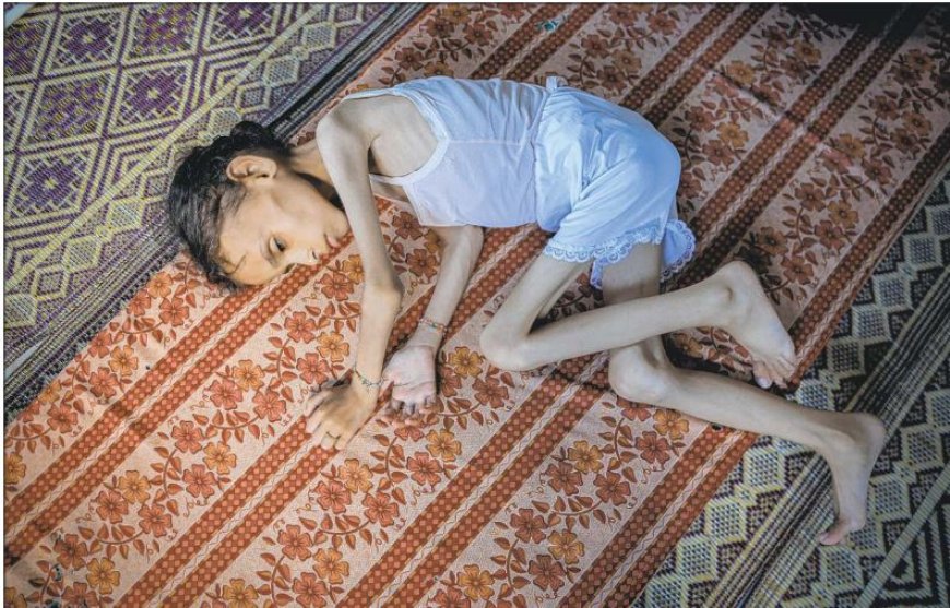 HONGERSNOOD TREFT KINDEREN IN GAZA