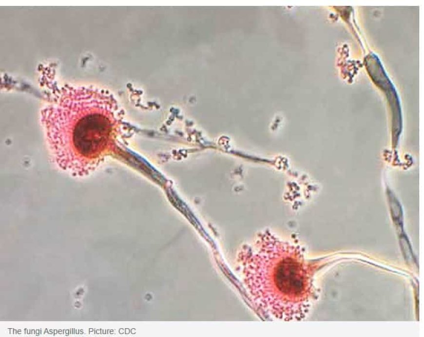 Wereldwijde waarschuwing voor dodelijke schimmel die ‘je van binnenuit kan opeten’