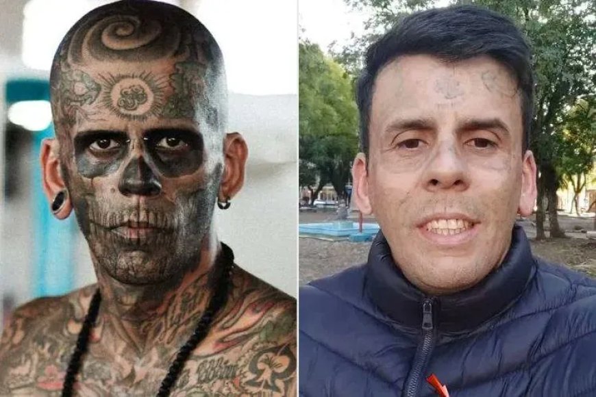 Opmerkelijk – Meest getatoeëerde man van Brazilië laat al zijn tatoeages weglaseren