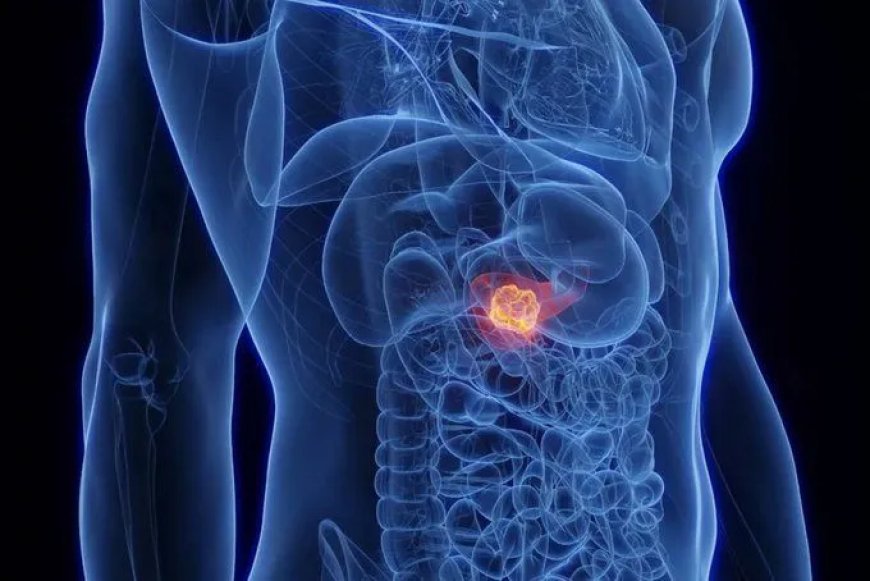 Grote doorbraak: Slechte mondhygiëne gelinkt aan verhoogd risico op alvleesklierkanker