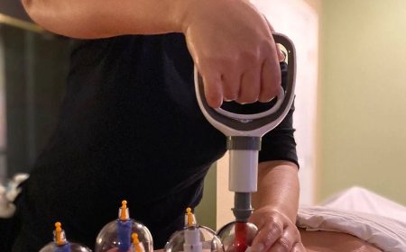 Man in China deels verlamd nadat hij zuignappen twee dagen op rug laat zitten bij cuppingmass