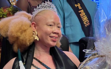 Mensen met albinisme strijden voor zichtbaarheid in Afrika