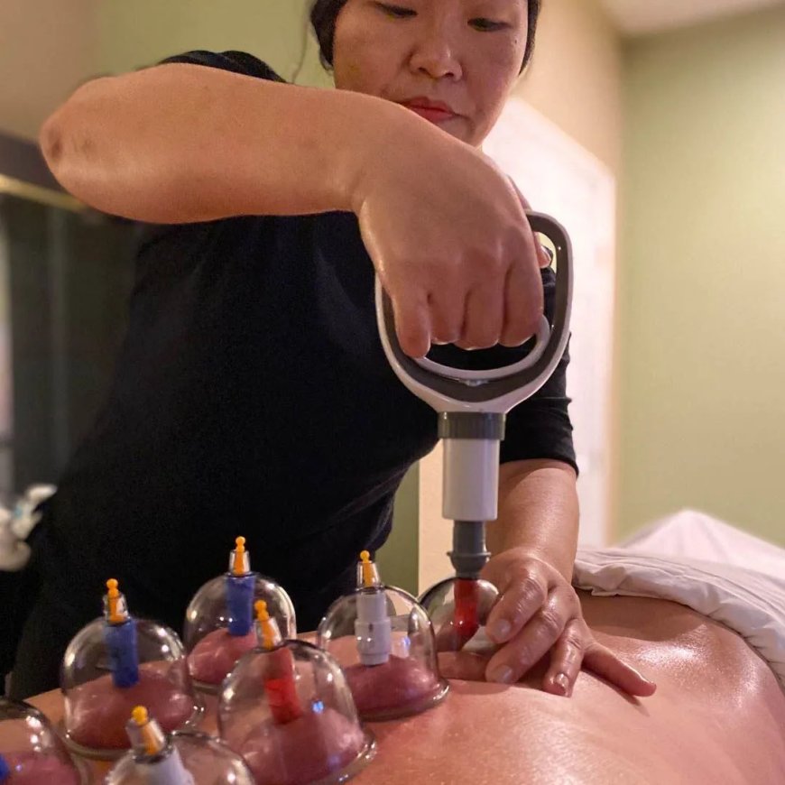 Man in China deels verlamd nadat hij zuignappen twee dagen op rug laat zitten bij cuppingmass