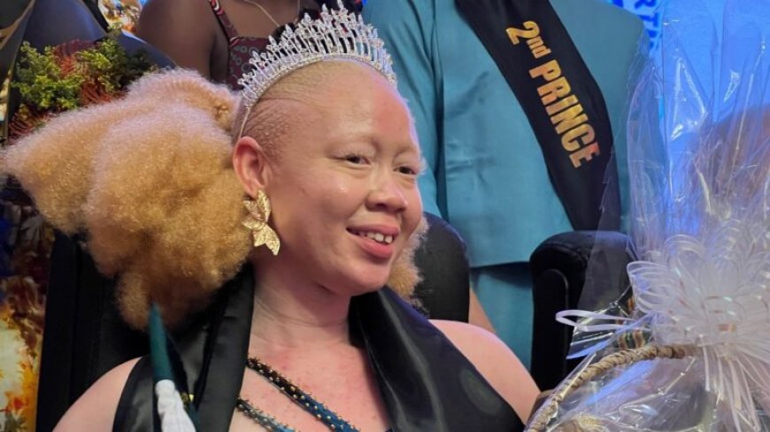 Mensen met albinisme strijden voor zichtbaarheid in Afrika