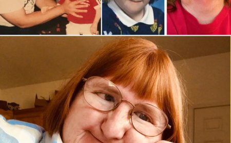 WIST U DAT: De Amerikaanse Melissa Blake iedere dag een selfie online postte om haar uiterlij