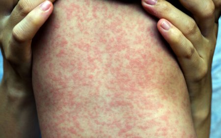 MAZELEN WEER TERUG IN DE REGIO