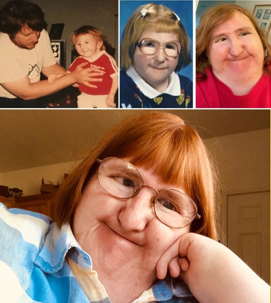 WIST U DAT: De Amerikaanse Melissa Blake iedere dag een selfie online postte om haar uiterlij