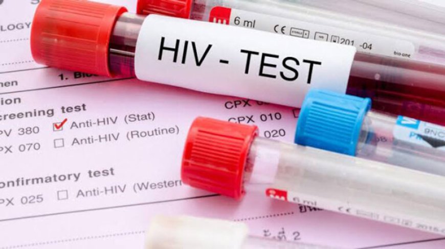 JONGEREN MOETEN HIV SERIEUS NEMEN