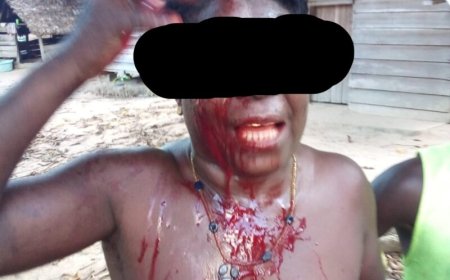 Drie gewonden bij ruzie om grond in Nieuw-Aurora