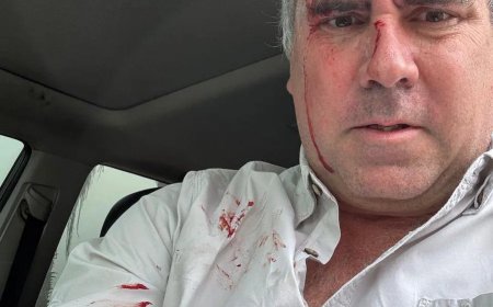 Peruaanse presidentskandidaten krijgen kogelwerende vesten na schietpartij