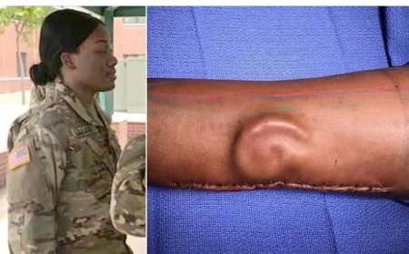 Soldaat krijgt nieuw oor na baanbrekende reconstructie