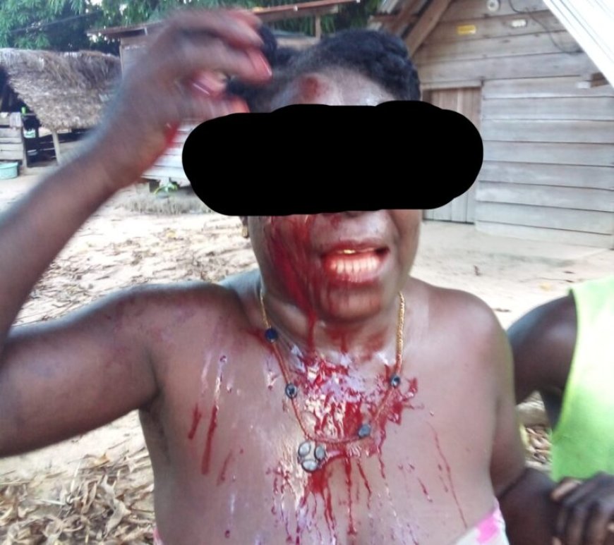 Drie gewonden bij ruzie om grond in Nieuw-Aurora