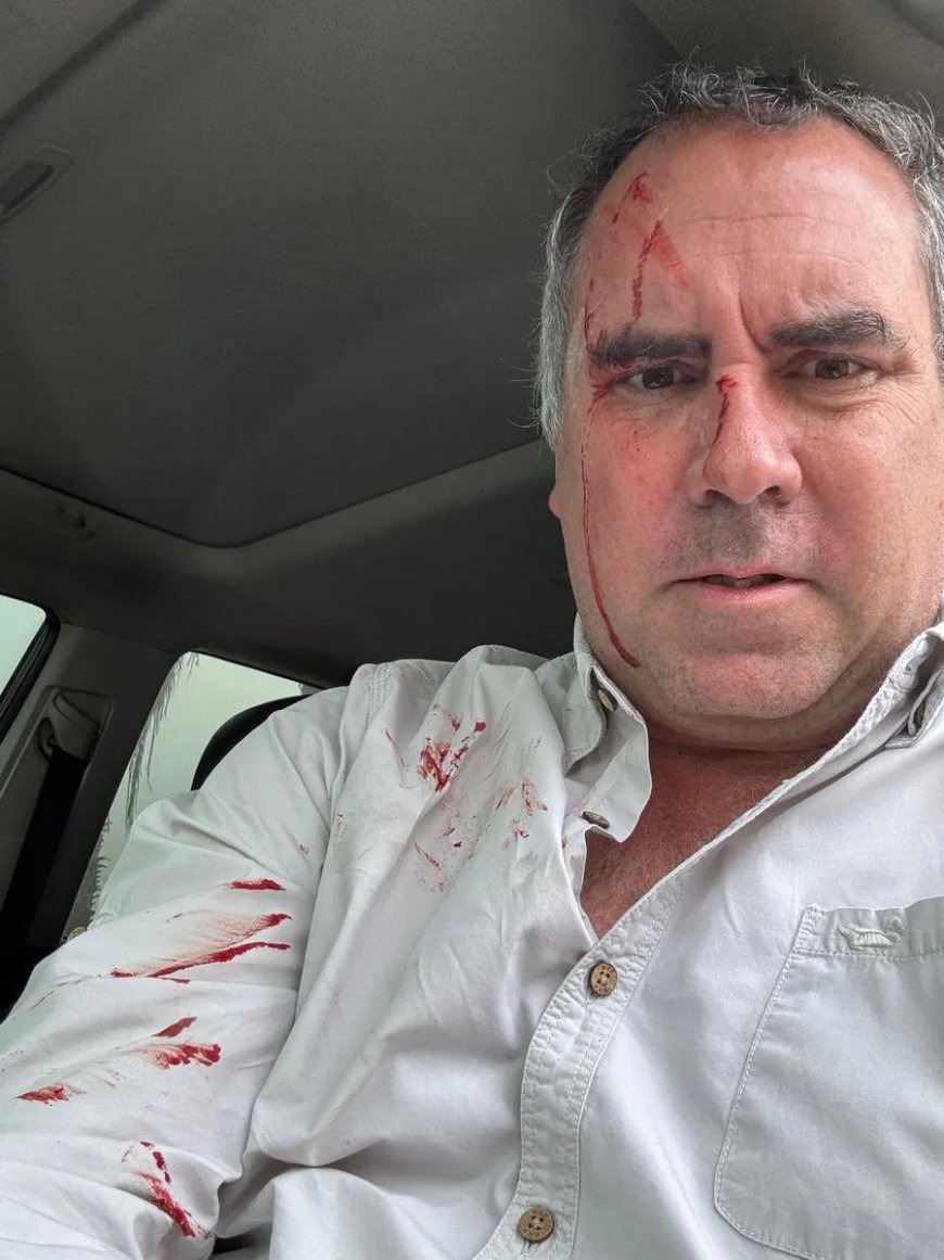 Peruaanse presidentskandidaten krijgen kogelwerende vesten na schietpartij