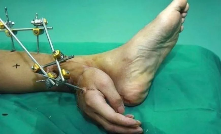 WIST U DAT: Hand van Chinese fabrieksarbeider tijdelijk aan enkel is vastgezet om amputatie t