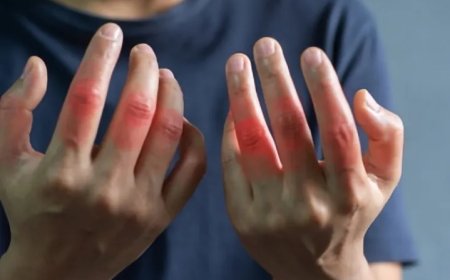 Reuma treft steeds meer mensen: wat je moetweten