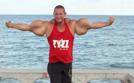 Braziliaanse ‘Popeye’-bodybuilder overleden na orgaanfalen