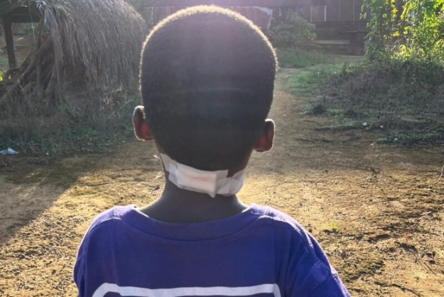 Achtjarige jongen aangevallen en verwond door poema