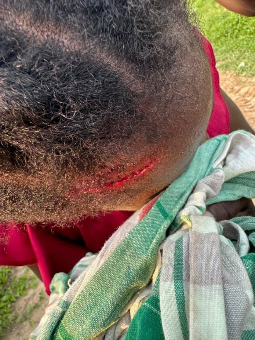 Arrestaties brengen slepend grondconflict Nieuw-Aurora in nieuwe fase