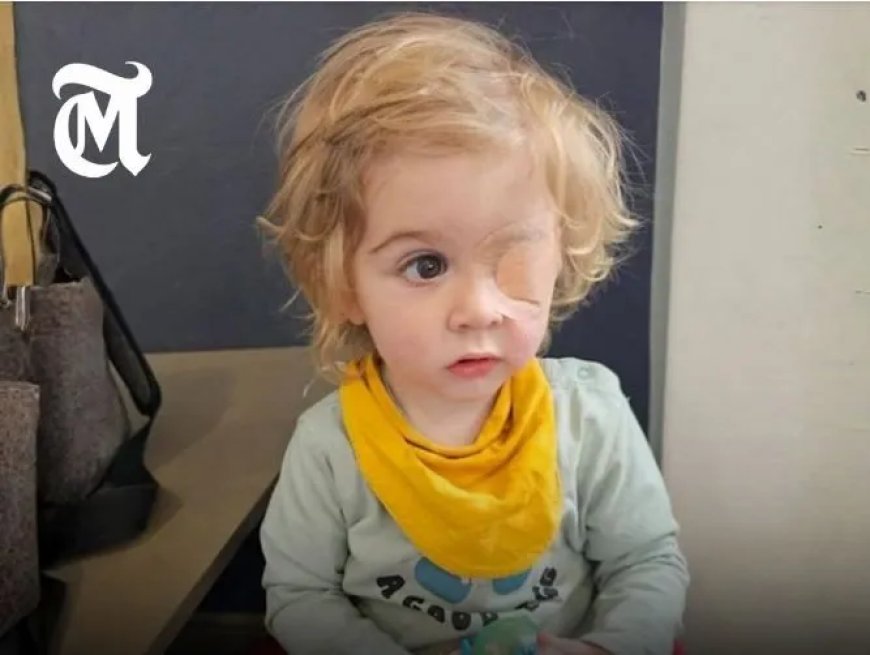 Herpesvirus veroorzaakt blijvend oogletsel bij peuter in VK