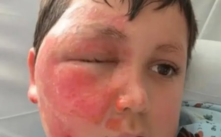 Opmerkelijk – Jongen (9) in VS loopt brandwonden op na in magnetron stoppen van speeltje