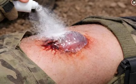 Revolutionaire spray stopt zware bloedingen vrijwel direct