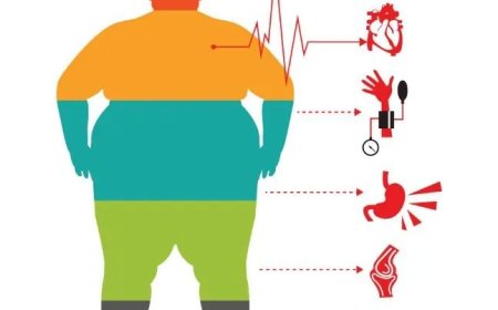 Obesitas: de stille ziekte die Suriname kwetsbaar maakt