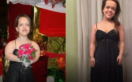 WIST U DAT: Chandler Crews groeide van 117 cm naar 150 cm door beenverlengingsoperaties?