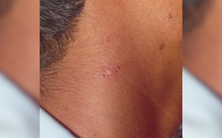 Minderjarige broers zeggen mishandeld te zijn door politie in Meerzorg