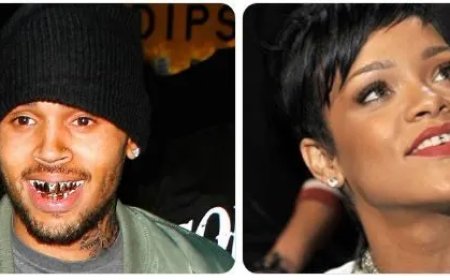 Tandjuwelen rukken op onder Surinaamse artiesten