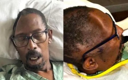 Ziekenhuis in Atlanta aangeklaagd na verlies van schedelstuk