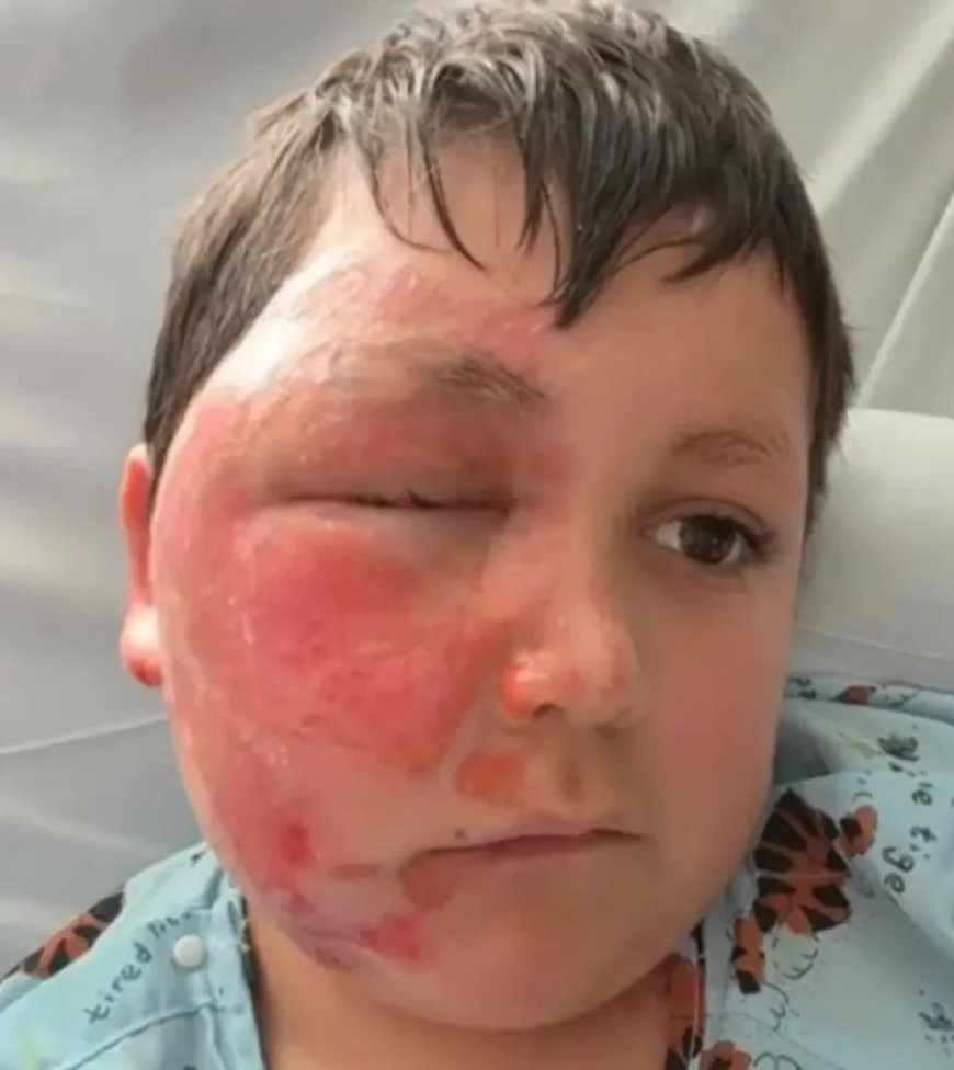 Opmerkelijk – Jongen (9) in VS loopt brandwonden op na in magnetron stoppen van speeltje