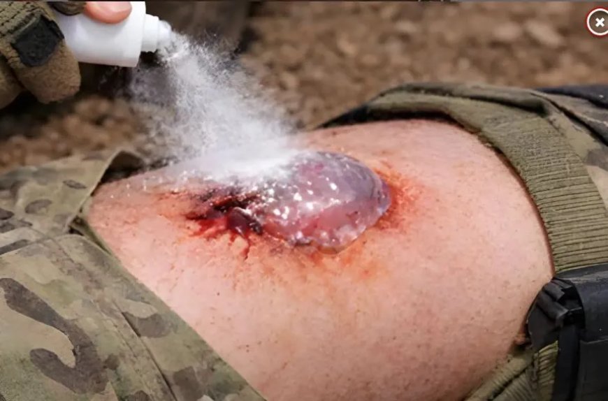 Revolutionaire spray stopt zware bloedingen vrijwel direct