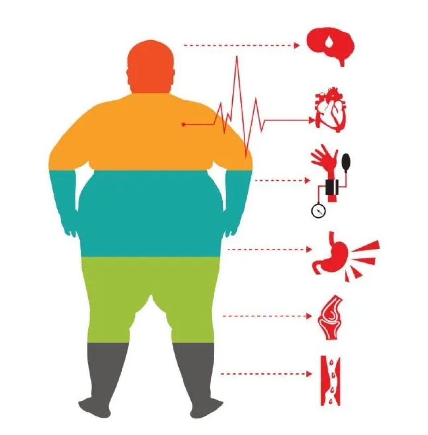 Obesitas: de stille ziekte die Suriname kwetsbaar maakt