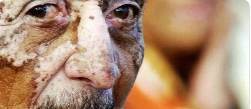 Bananenplantages en pesticiden weer in de belangstelling na uitspraak over onvruchtbaarheid