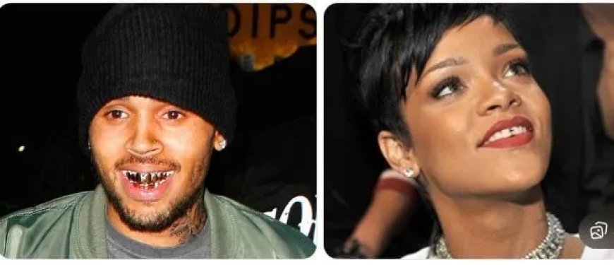 Tandjuwelen rukken op onder Surinaamse artiesten