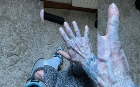 Man wordt blauw door nieuwe lakens