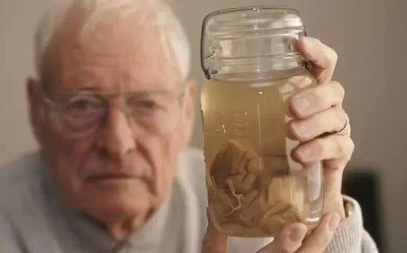 WIST U DAT: Een arts de hersenen van Albert Einstein had gestolen?