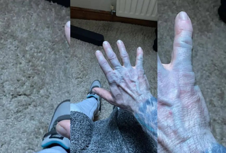 Man wordt blauw door nieuwe lakens