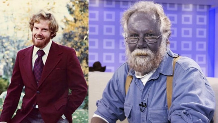 WIST U DAT: De blauwe Amerikaan ‘Papa smurf’ in september 2013 overleed?