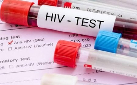Gezondheidsinstanties zetten in op meer hiv-testen en behandeling