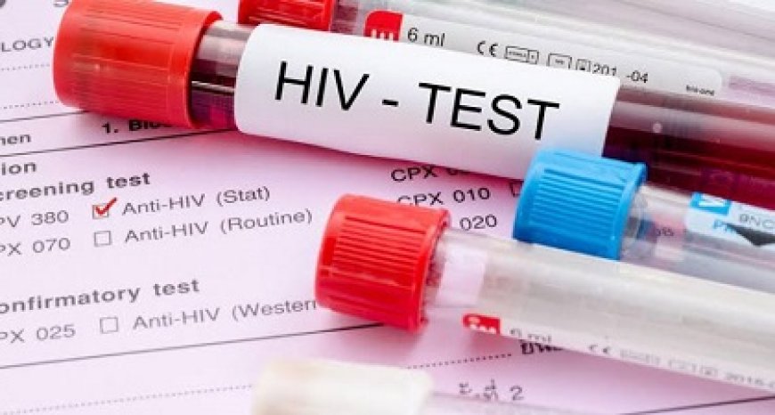 Gezondheidsinstanties zetten in op meer hiv-testen en behandeling
