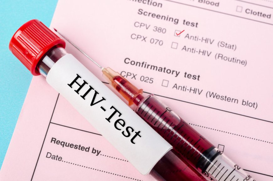 Gezondheidsinstanties houden landelijke campagne tegen hiv-besmettingen
