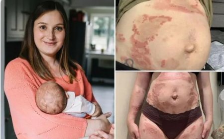 Zeldzame zwangerschapsziekte maakt moeder allergisch voor eigen baby