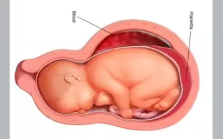 Pakistaanse inlichtingendienst onderzoekt illegale handel in placenta’s