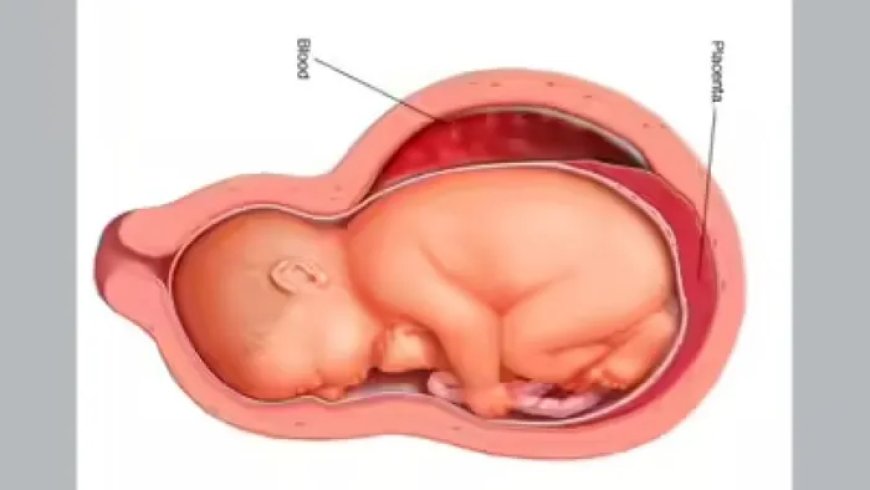 Pakistaanse inlichtingendienst onderzoekt illegale handel in placenta’s